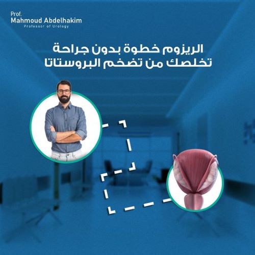 مميزات علاج تضخم البروستاتا بالتبخير